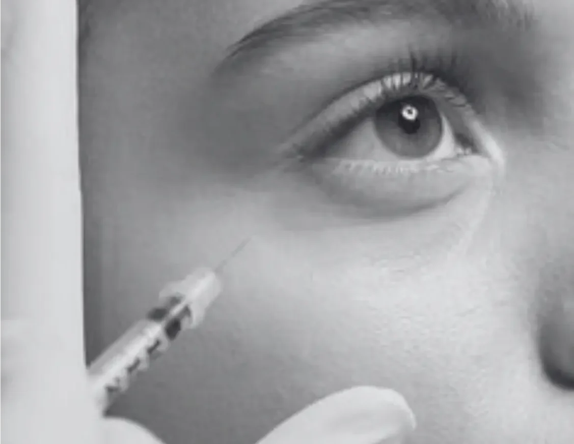 RESTYLANE PROCEDURE