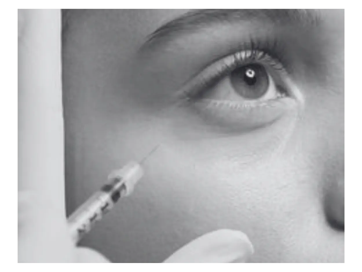 RESTYLANE PROCEDURE