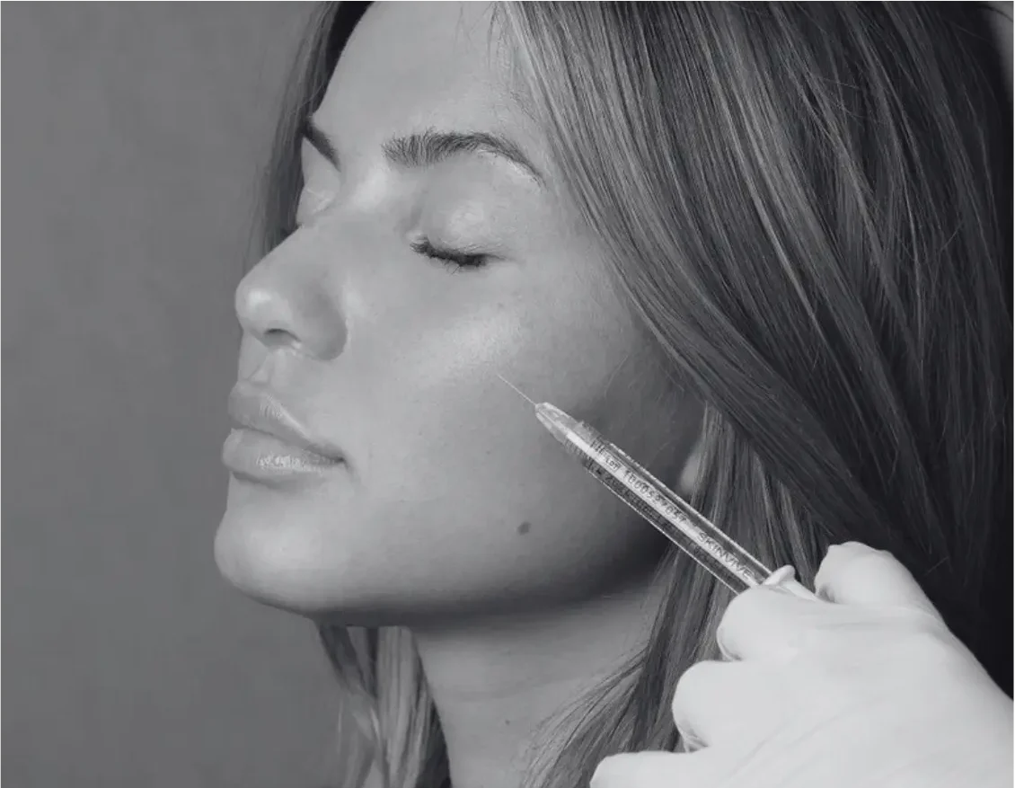 RADIESSE TREATMENTS