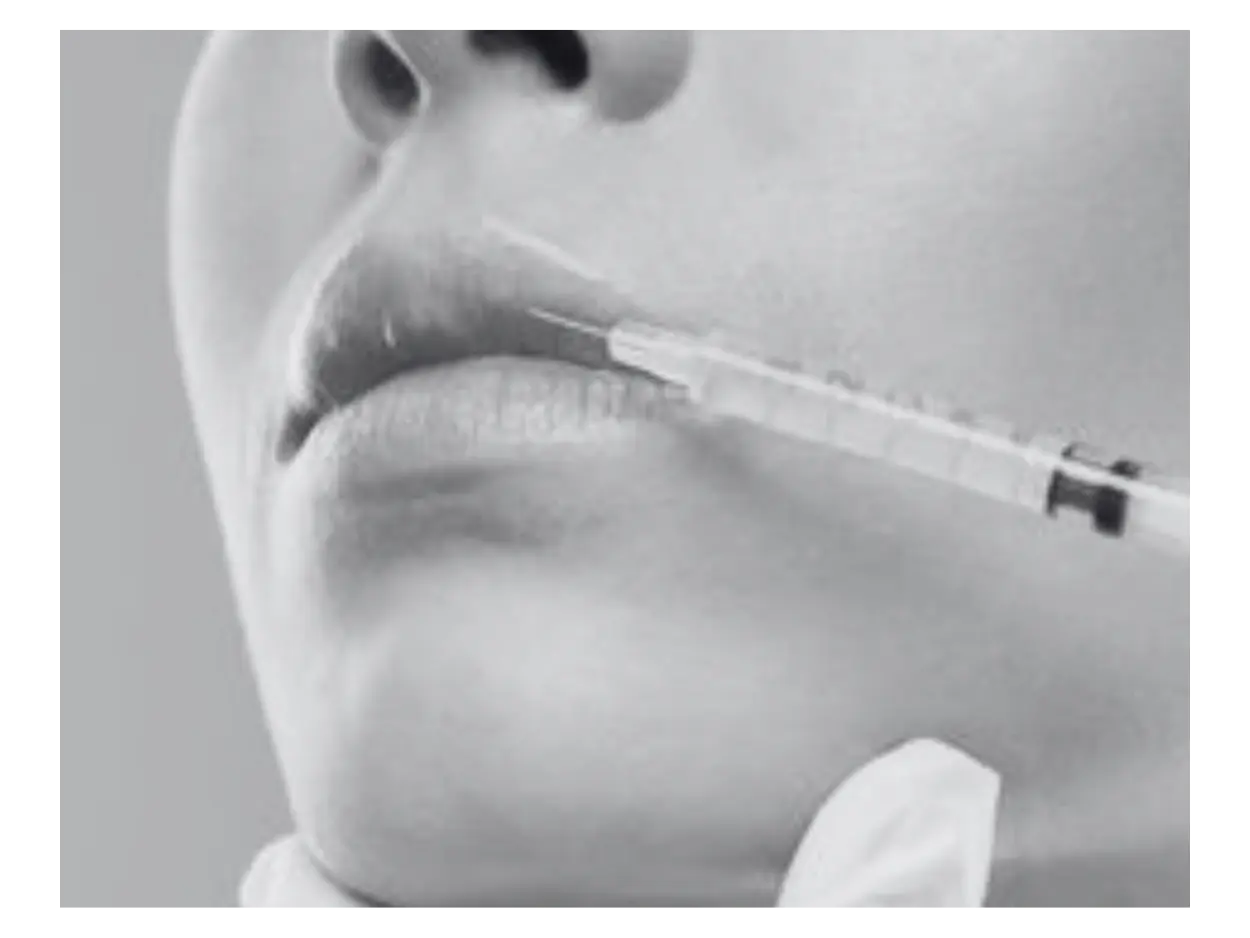 LIP FILLER INJECTIONS