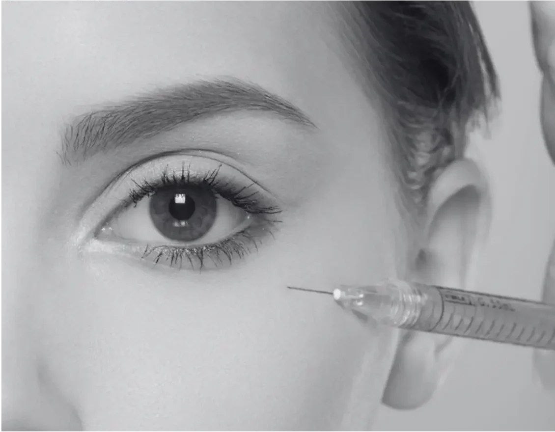 UNDEREYE FILLERS TREATMENT