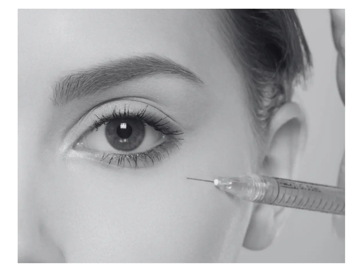 UNDEREYE FILLERS TREATMENT