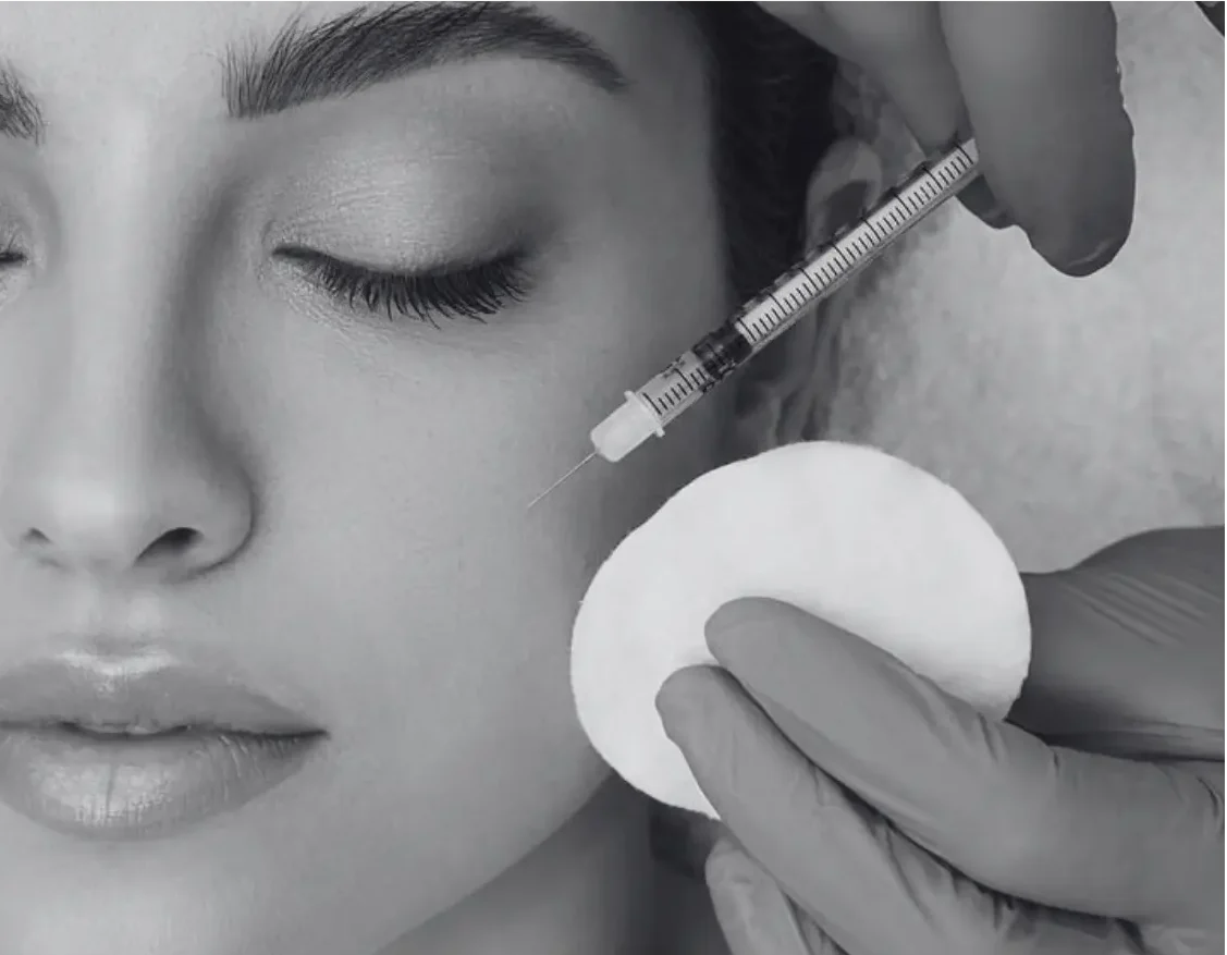 CHEEK FILLER INJECTION
