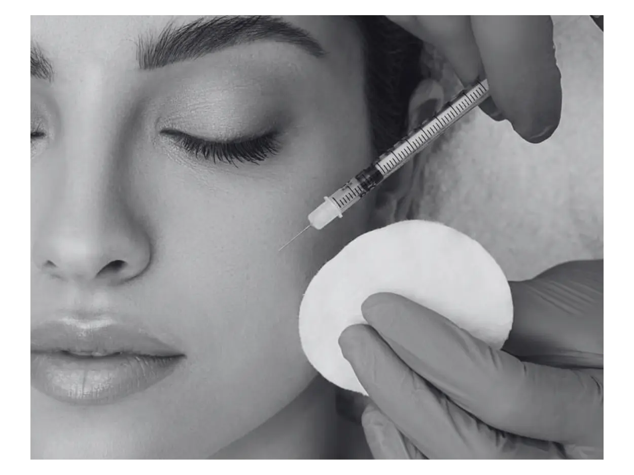 CHEEK FILLER INJECTION