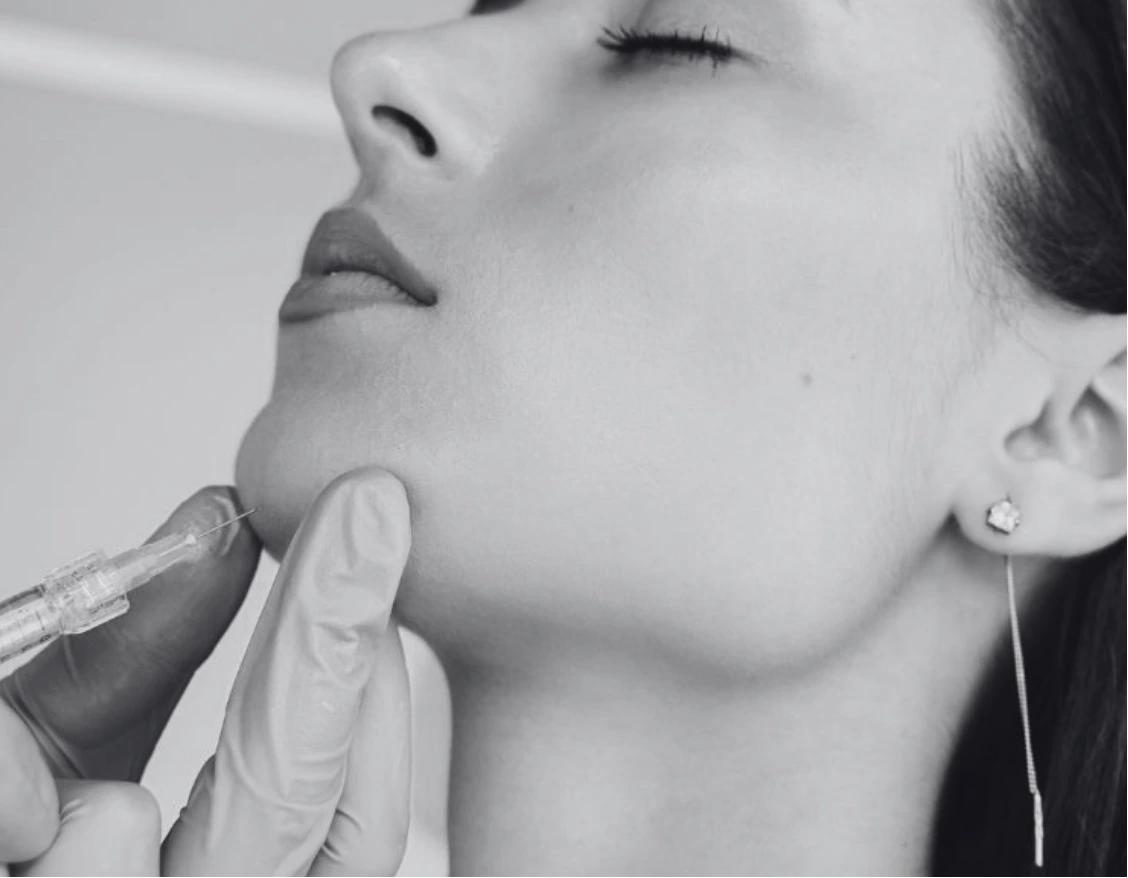 CHIN AUGMENTATION WITH FILLERS