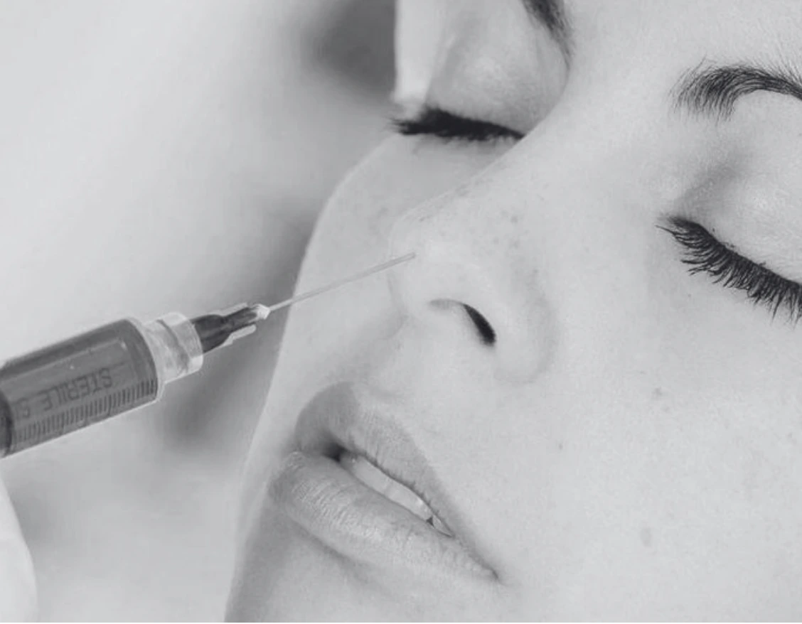 NON-SURGICAL RHINOPLASTY