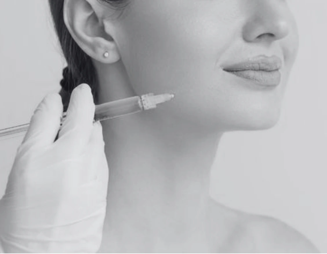 JAWLINE CONTOURING WITH FILLERS