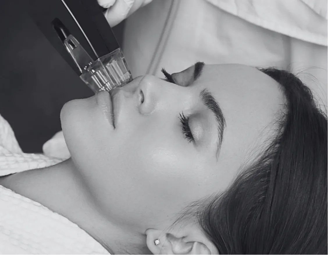 MORPHEUS8 RF MICRONEEDLING