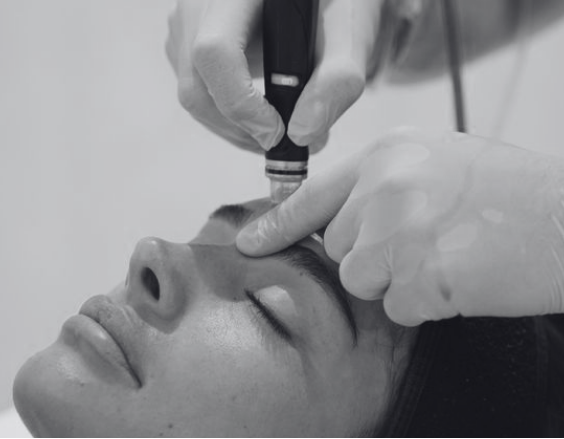 HYDRAFACIAL TREATMENT