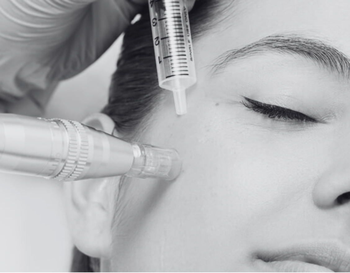 MESOTHERAPY