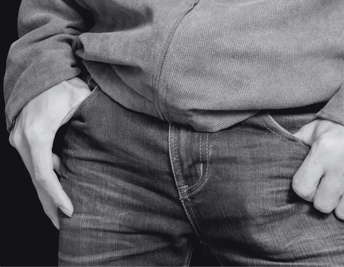 PENILE AUGMENTATION