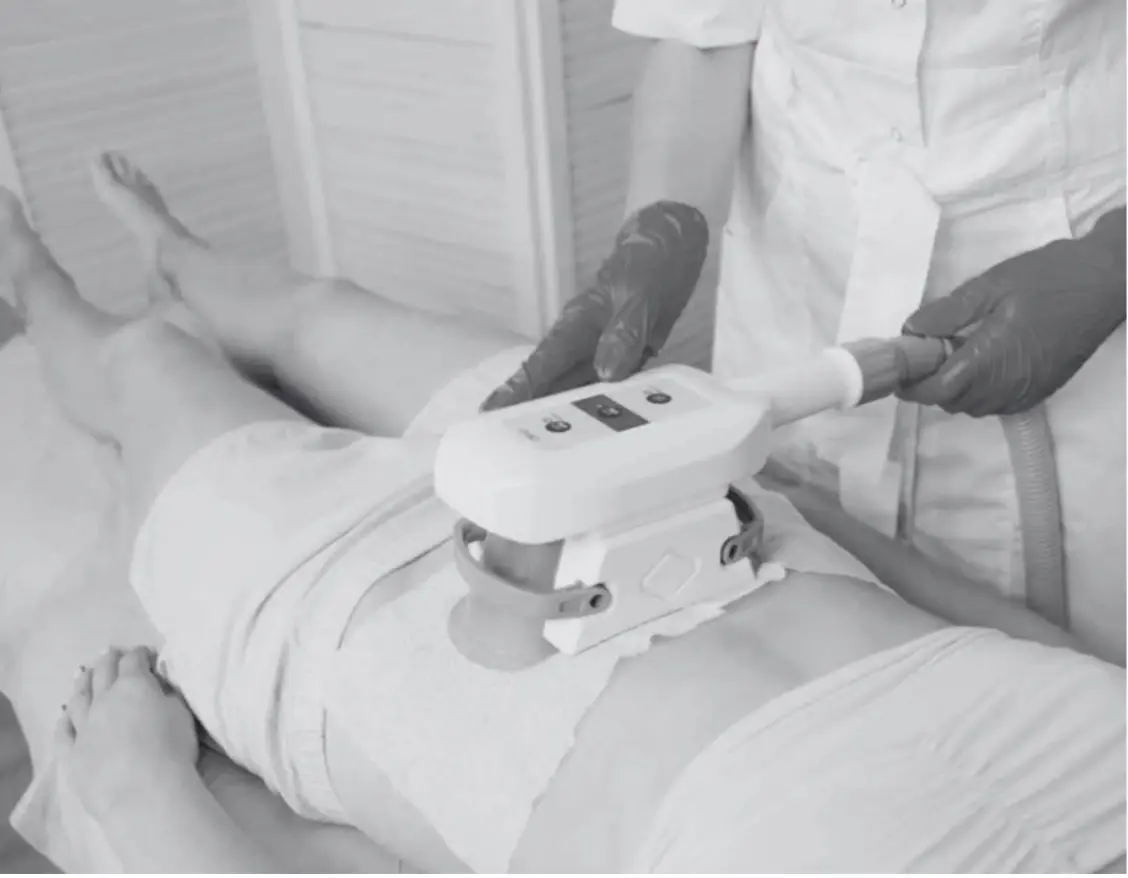 COOLSCULPTING